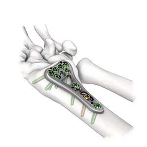 Caja de Aluminio para Instrumentos Quirúrgicos Ortopédicos, Caja para Placas y Tornillos de Radio Distal, Precio de Fábrica, por Dentavex - Product Image 5