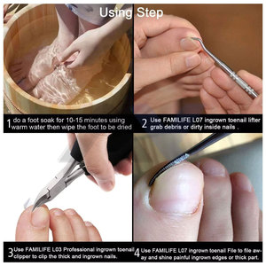 Juego profesional de 2 herramientas de acero inoxidable 100% para levantar uñas encarnadas, limas de doble cara para uñas, con almacenamiento. - Product Image 5