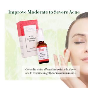 Crema correctora de manchas de acné con azufre al 10% de marca privada, hidratante para el cuidado de la piel con acné. - Product Image 5