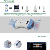 Profesional New Pocket Palm 80 Elements Wireless USG Convex/Linear Phased Probe untuk Iphone dan Ipad