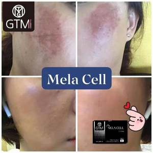 GTM MELACELL+ บูสเตอร์ผิวกระจ่างใส แอมพูล กลูต้าไธโอน PDRN ทรานเน็กซามิก แอซิด ลดเลือนจุดด่างดำ ผิวเปล่งประกาย ผลิตภัณฑ์บำรุงผิวสไตล์เกาหลี - Product Image 5