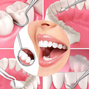 Kit Dental Manual de Alta Calidad para Blanqueamiento Dental, Espejo, Pinzas, Set Básico de Examen Dental, CE ISO, Marca Grip Surgical - Product Image 6