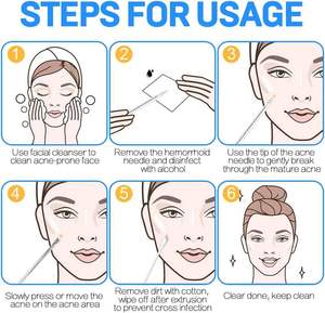 Extracteur de points noirs et d'acné 2-en-1 UBI avec boucle et pointe fine pour le nettoyage des pores du visage - Product Image 4