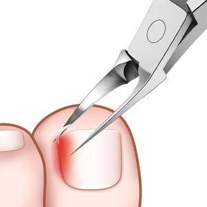 กรรไกรตัดเล็บมืออาชีพ, คีมตัดเล็บ, กรรไกรตัดหนังกำพร้าสแตนเลส, อุปกรณ์กำจัดหนังส่วนเกิน, กรรไกรตัดเล็บเท้า, กรรไกรตัดเล็บทรงปากนกอินทรี - Product Image 5