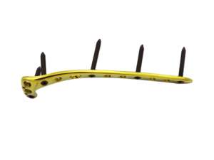 Plaque de blocage tibiale manuelle chirurgicale vétérinaire orthopédique en acier inoxydable de haute qualité - Product Image 2