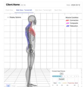 Analizador de Salud Corporal Inteligente Bodydot BDF1000 con IA, Marco Flexible de Aleación de Aluminio, No Plegable, Seguimiento de Postura Corporal Completa - Product Image 3