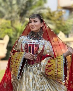 Robe bohème vintage tribale afghane Kuchi en 3 pièces pour femmes, décoration en dentelle, tailles et couleurs personnalisables, robes décontractées pour femmes - Product Image 3