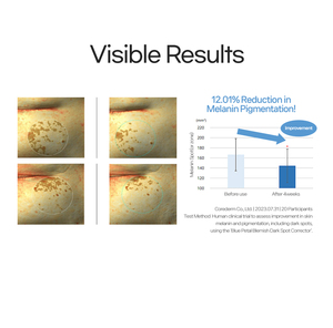 Crème Correctrice Anti-Taches Bleu Pétale Éclaircissante Unifiante Soin Hyperpigmentation Hydratant Visage Blanchissant Après-Soin - Product Image 6