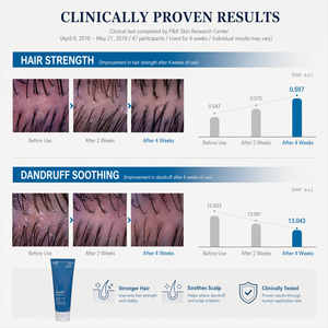 Scalp Care <b>Shampoo</b> for Thinning Hair Loss Treatment Protein Repair Oil Control Deep Cleansing Biotin Coral Calcium Niacinamide - Product Image 5