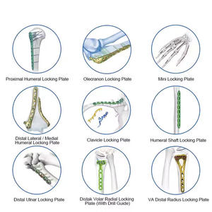 Ensemble de plaques de fixation orthopédiques en acier inoxydable |   Instruments chirurgicaux pour traumatismes osseux, instruments manuels Surgiright - Product Image 3