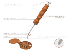 Kit de fixation osseuse automatique en titane GBR avec vis osseuses dentaires à bouton unique 2.0 2.5 – Instrument chirurgical - Product Image 3