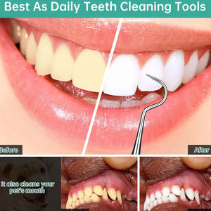 Escaladores Dentales de Buena Calidad al por Mayor, Escaladores Dentales al Mejor Precio, Instrumento de Limpieza Dental, Escaladores de Uso Manual - Product Image 4