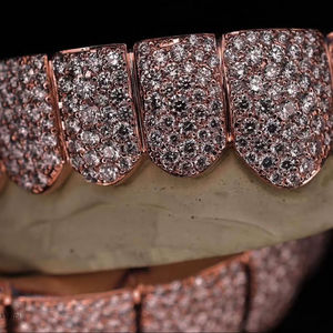Ensemble de grillz hip-hop de luxe en or rose avec diamants Moissanite, grillz dentaires personnalisés entièrement sertis de Moissanite VVS, bijoux de style rappeur - Product Image 4