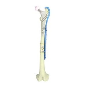 Placa femoral lateral proximal de trocantero ICP profesional personalizada, placa de bloqueo de titanio, manual, certificada ISO13485 - Product Image 2