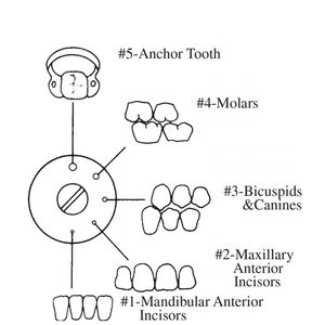 Kit dentaire manuel de qualité supérieure en acier inoxydable, instruments chirurgicaux incluant un kit de barrage dentaire, un cadre, des pinces, des crochets, un perforateur, certifié CE - Product Image 5