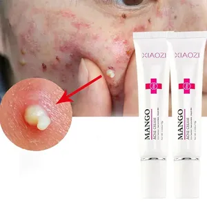 Medicina trattamento dell'acne restringe i pori macchie Gel creme sbiancanti crema idratante per il viso