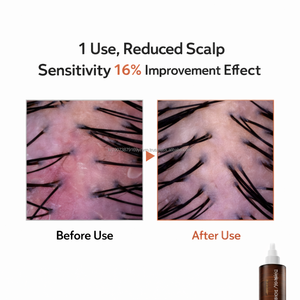 Suero Esencial para el Equilibrio del Cuero Cabelludo con Levadura de Cerveza Vegana Orgánica K Beauty, Marca Privada Personalizada - Product Image 2