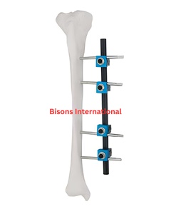 Kit chirurgical orthopédique BISONS de haute qualité pour la fixation des fractures du tibia et du fémur, avec instruments de fixation externe des membres inférieurs - Product Image 1