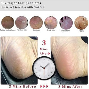 Removedor de callos para pies, lima de pedicura negra para piel muerta, callosidades y raspado de callos, herramienta duradera de madera de haya para pies - Product Image 3