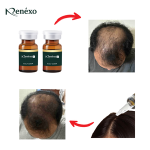 Nuevo Sérum Facial con Péptidos Orgánicos 2026, Calidad Superior, Antienvejecimiento, Hidratante, Previene la Caída del Cabello, Cuidado Diario de la Piel - Product Image 1