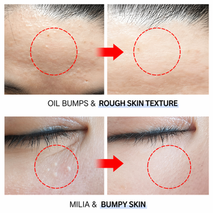 Crema Multi-Emulsión Hipermineral Dr. Deep, Hidratante, Calmante, Cuidado de la Barrera Cutánea para Piel Sensible y Seca - Product Image 5