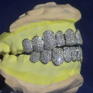 Grillz dentaire Hip Hop personnalisé en argent 925 plaqué rhodium, serti de pierres, certifié IGI, bijoux corporels unisexe, meilleur prix - Product Image 3
