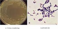 Probiotiques Lactobacillus Lactis en poudre blanche de la marque IGC, 5 à 100 milliards d'UFC/g, sachet en aluminium pour soins de santé, durée de conservation de 18 à 24 mois