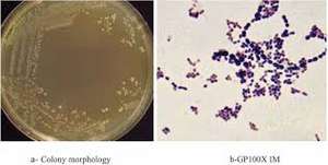Probiotiques Lactobacillus Lactis de la marque IGC, origine Maharashtra - Product Image 3