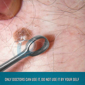 Curettes dermatologiques réutilisables en acier inoxydable, qualité supérieure, sur mesure - Product Image 6