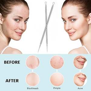 Outils professionnels pour éliminer les points noirs, extracteurs de boutons réutilisables, fabriqués avec des matériaux de haute qualité - Product Image 4