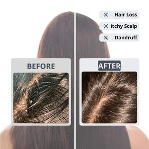 ERIGERON Boule de shampooing végétalien tout en un Soin des cheveux solides au charbon noir - Product Image 2