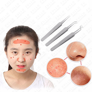 Juego de Pinzas para Eliminar Puntos Negros, Puntos Blancos y Espinillas Faciales, Herramienta Avanzada para el Cuidado de la Piel Facial con Logotipo Personalizado y Diseño Personalizado - Product Image 1