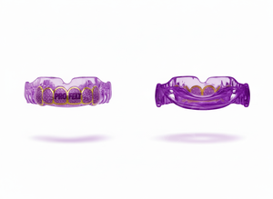 Lightweight Flexible Mouth Guard for Boxing MMA Teeth Protection Boil & Bite Mouthpiece for Adults & Youth Sports Dental Guard - Product Image 2