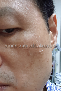 Set de Peeling Facial con Ácido Hialurónico y Espículas de Esponja para Reafirmar la Piel, Corregir la Pigmentación y Rejuvenecer (Marca Privada) - Product Image 3