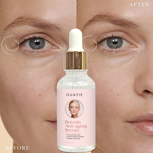 Suero Revitalizante con Vitaminas de Marca Blanca de 30 ml - <span class=keywords><strong>para</strong></span> Hidratación Diaria y Mejora de la Apariencia de Líneas Finas - Product Image 5