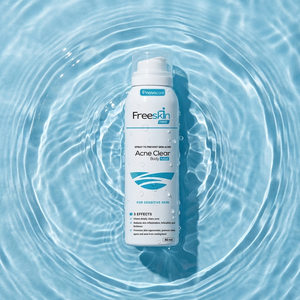 Bruma Corporal Antiacné de Alta Calidad 80ml ODM/OEM Marca Privada, Fórmula Suave, Limpieza Profunda de la Piel, Reduce el Acné Corporal - Product Image 5