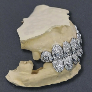 Grillz dentaire Hip Hop personnalisé en argent 925 plaqué or, serti de moissanite, bijoux de corps de luxe - Product Image 3