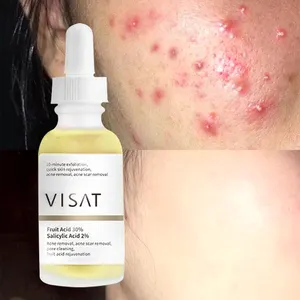 OEM Serum kosmetik perawatan kulit wajah, Produk Perawatan Serum asam Azelaic penghilang jerawat