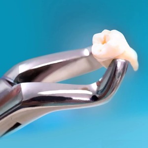 Pinzas Apicales Manuales de Alta Resistencia para Uso Dental, Pinzas de Extracción Tipo Cuerno de Vaca para Molares Inferiores, Atraumáticas - Product Image 2