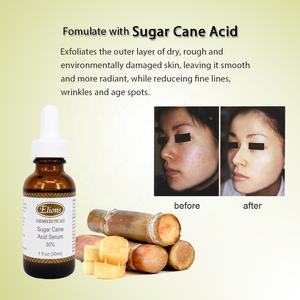 A.H.A Acide de canne à sucre 30% Gel exfoliant anti-rides raffermissant Nettoyage en profondeur des points noirs Sérum éclaircissant correcteur de taches brunes - Product Image 4