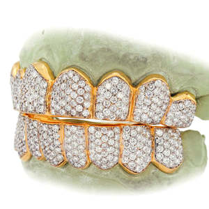 Grillz Hip Hop de Luxe Plaqué Or, Ensemble Complet Sertie de Diamants Ronds, Finition Personnalisée, Bijoux pour Dents - Product Image 4