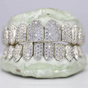 Grill dentaire vintage Provence en argent 925 avec moissanite et poussière de diamant, style Hip Hop, ajustement personnalisé, bijou dentaire, déclaration de mode - Product Image 1