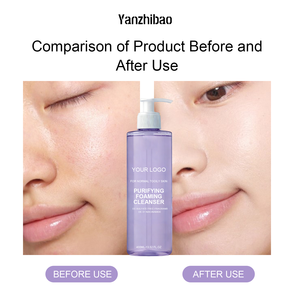 <span class=keywords><strong>โฟม</strong></span><span class=keywords><strong>ล้าง</strong></span><span class=keywords><strong>หน้า</strong></span>สูตรอ่อนโยน OEM ผสมไนอะซินาไมด์ ปราศจากน้ำ<span class=keywords><strong>มัน</strong></span> สำหรับ<span class=keywords><strong>ผิว</strong></span><span class=keywords><strong>มัน</strong></span>และ<span class=keywords><strong>ผิว</strong></span>แพ้ง่าย - Product Image 2