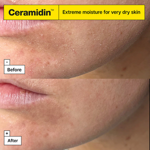 <span class=keywords><strong>Crema</strong></span> Facial <span class=keywords><strong>Dr</strong></span>.<span class=keywords><strong>Jart</strong></span>+ <span class=keywords><strong>Ceramidin</strong></span> con Ectoína 50ml, Hidratante Facial - Product Image 3