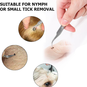 Juego de Pinzas para Eliminar Garrapatas de Animales, Acero Inoxidable de Grado Quirúrgico, Alta Demanda, 3 Piezas, para Perros, Gatos y Humanos - Product Image 3
