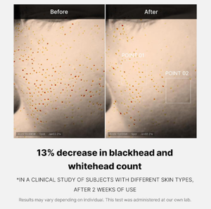 Medicube Zero Pore One-Day Glycerin Moisturizer Serum 30ml per il Viso, Autentico Prodotto in Corea - Product Image 4