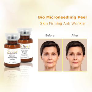 Suero Reafirmante de Piel con Espículas de Esponja, Corrector de Pigmentación Facial, Ampolla Reparadora con Aloe Vera y Ácido Hialurónico, Marca Privada - Product Image 6