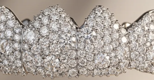 Grillz dentaire unisexe en argent sterling 925, synthétique HPHT CVD, avec mosaïque dentaire supérieure et inférieure, qualité VVS VS, pour un look raffiné - Product Image 2