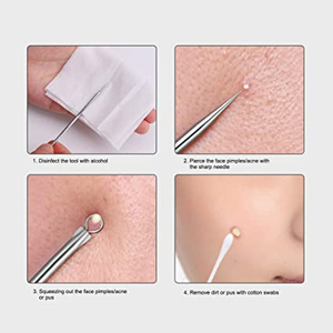 Nouvel outil élégant en acier inoxydable à double extrémité pour le soin du visage, anti-points noirs, aiguille à acné, avec manche antidérapant, unisexe - Product Image 3
