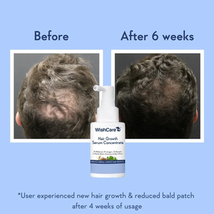 Set de Cuidado Capilar, Suero Concentrado para el Crecimiento del Cabello con Agua de Arroz, Tratamiento para el Cuidado del Cuero Cabelludo, Promueve el Crecimiento, Previene la Caída del Cabello, Tónico 30ml - Product Image 5